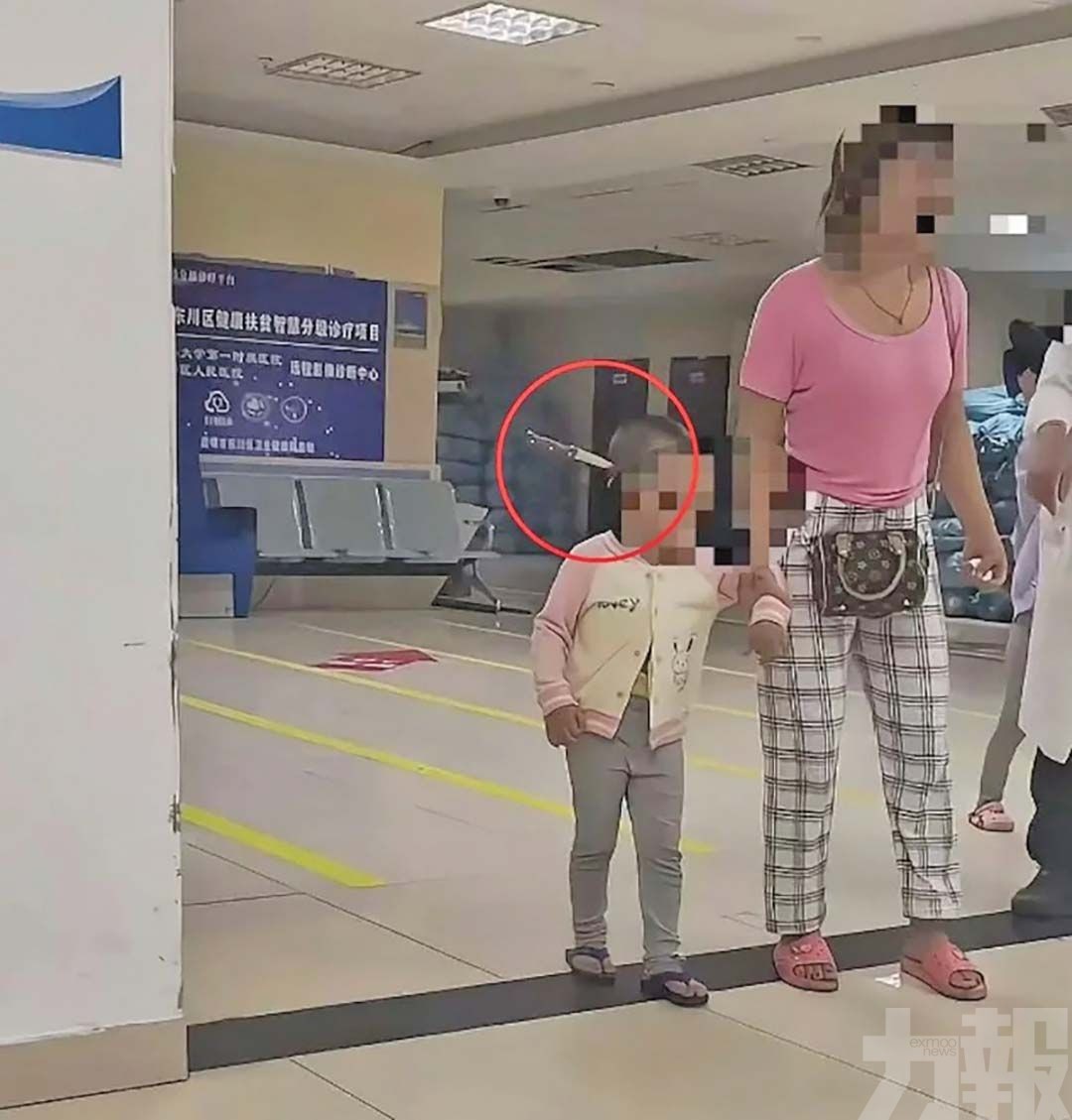 三歲女童頭插水果刀淡定就醫