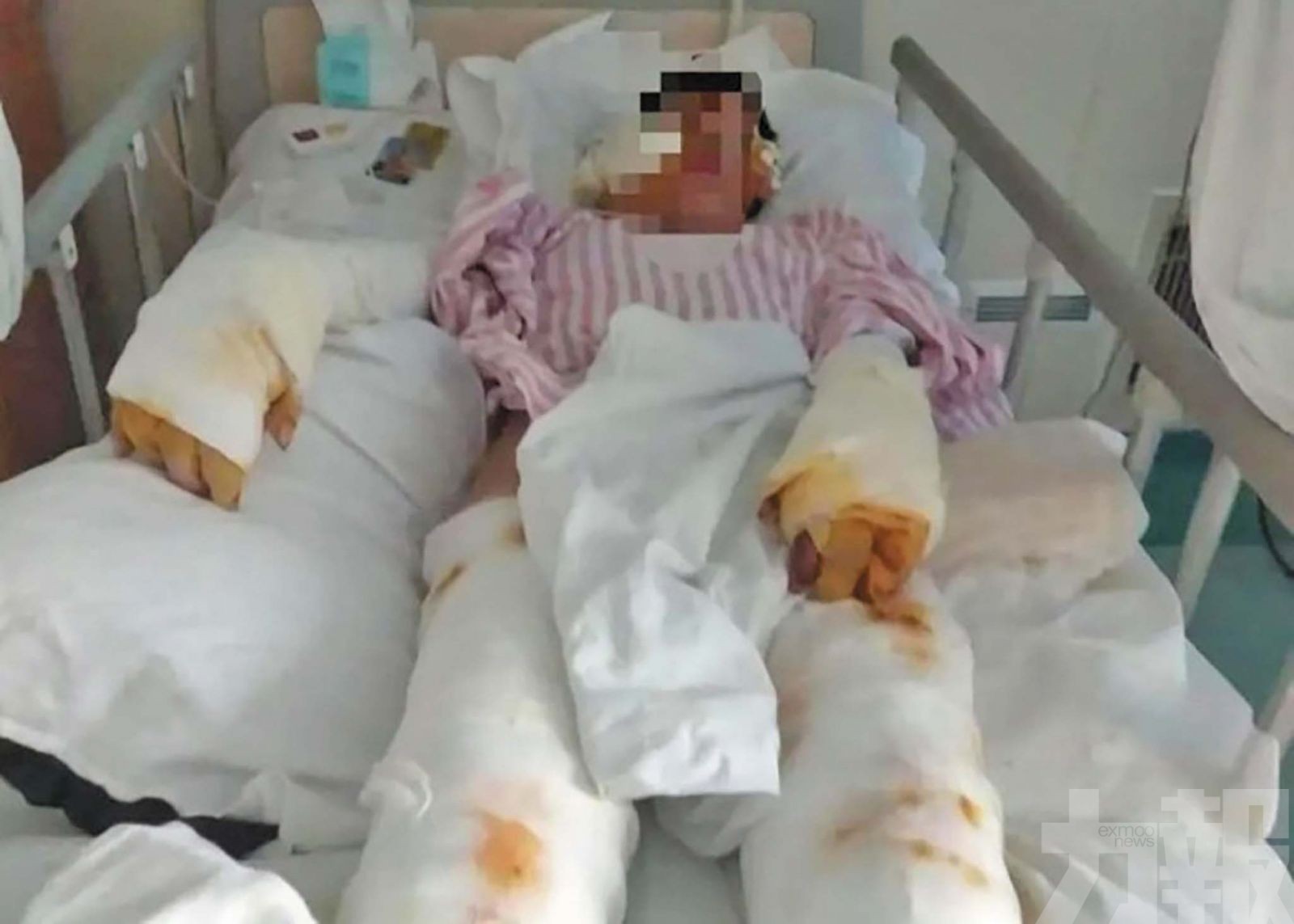 佛山男追求不成潑酸捅刺數十刀被判死