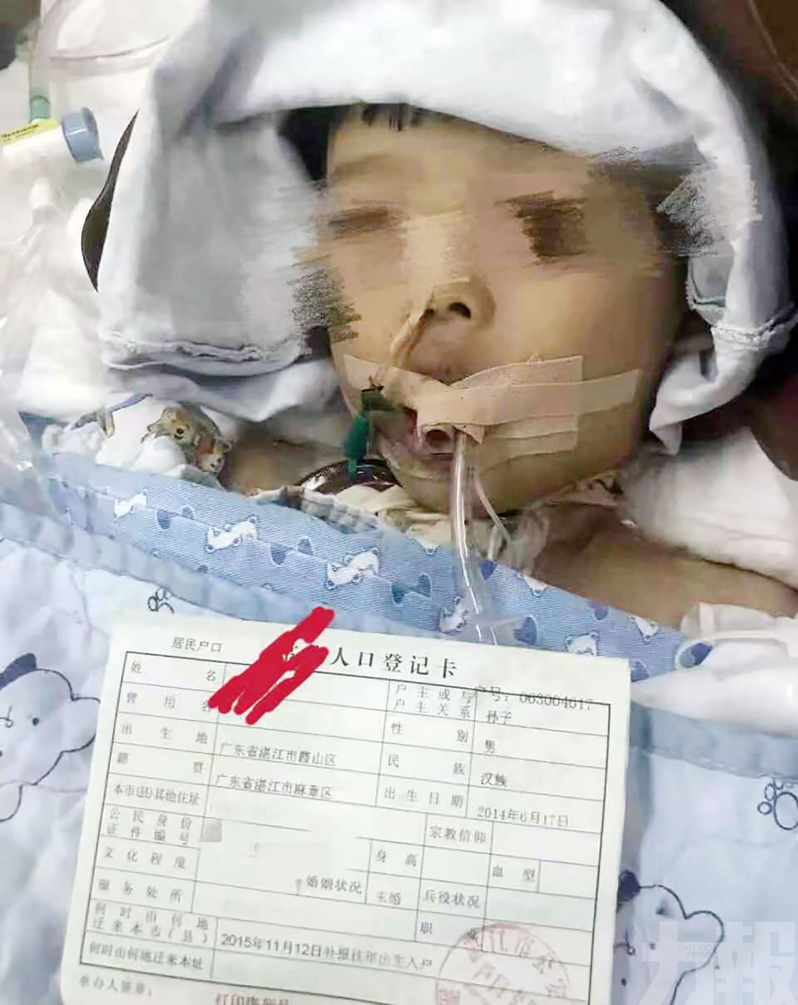 疑老鼠藥中毒