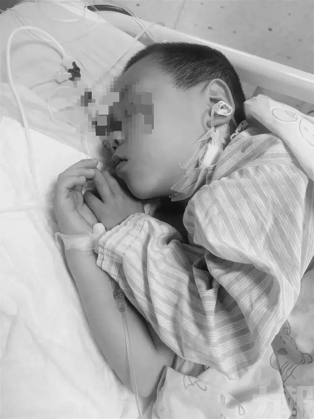 湖南5歲男童食毒蘑菇不治