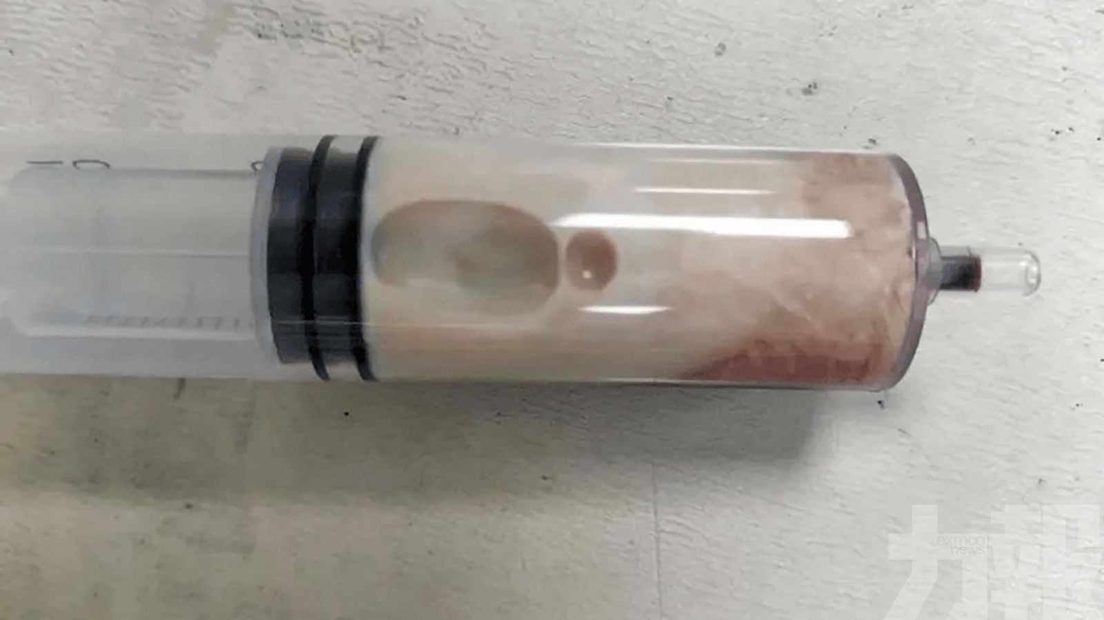 寧波男子連假暴飲暴食急送醫