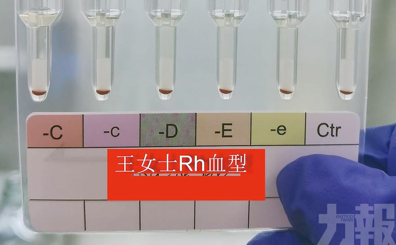 全球不足50例