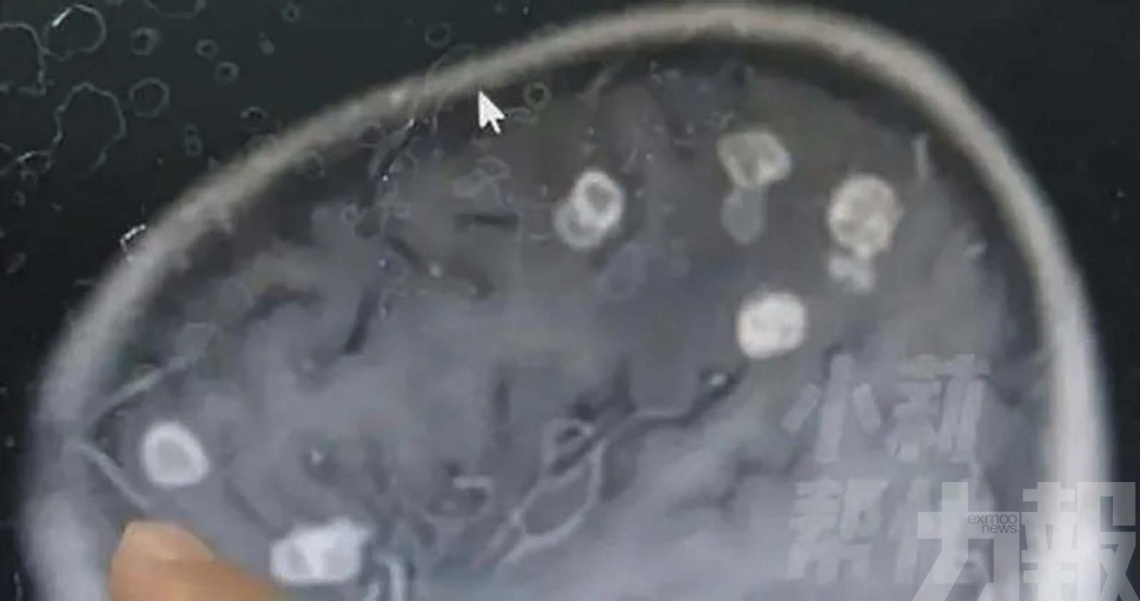 大掃除後連燒17天